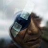 Augenpatient in Nepal EPA/NARENDRA SHRESTHA